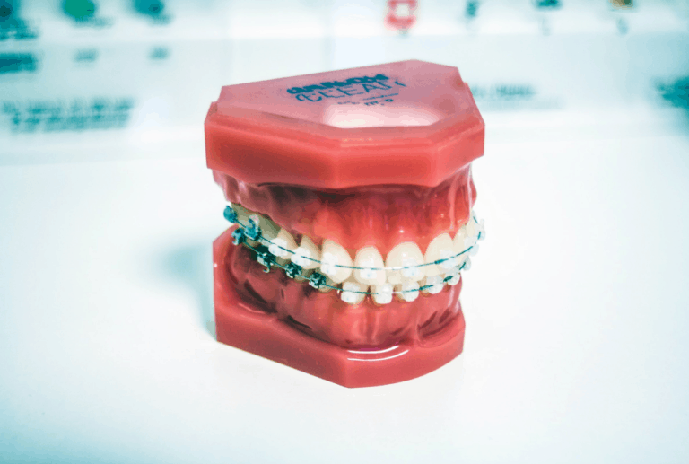 Best Toothpaste for Braces Top 5 Picks You'll Love Dentalisty